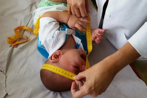 INSS pagará indenização de R$ 60 mil a crianças vítimas de zika