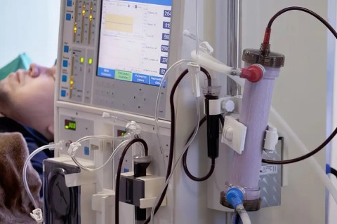 Estudo alerta para subdiagnóstico da doença renal crônica no Brasil